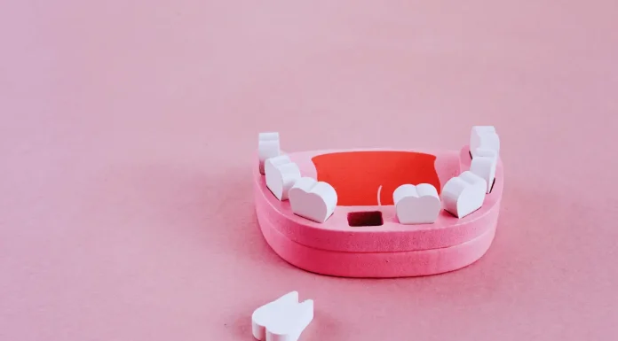 What Not to Do After Dental Implant Installation? Dental Implants