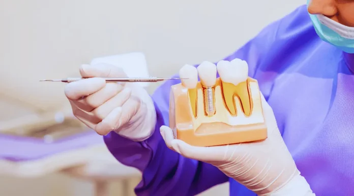 Implant Dentistry: Improving Oral Health and Quality of Life Implant Dentistry