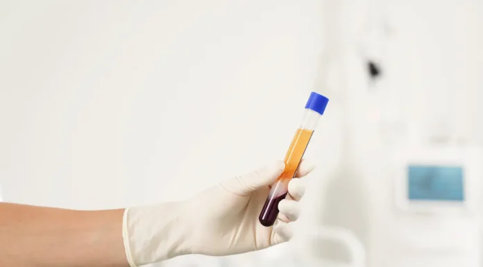 Platelet-Rich Plasma (PRP) in Regenerative Medicine for Joint Pain Platelet-Rich Plasma