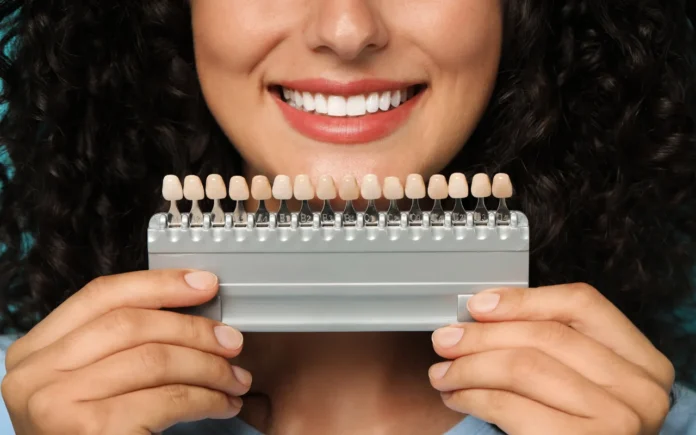 Dental Veneers Dental Veneers